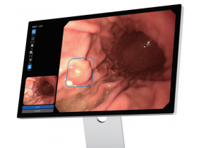 Phần mềm AI hỗ trợ chẩn đoán và phân loại tổn thương cho dạ dày và đại tràng